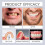 (1pcs)1/2/3x Advanced Customized Full Denture Set, Silicone Reline Denture Set 3