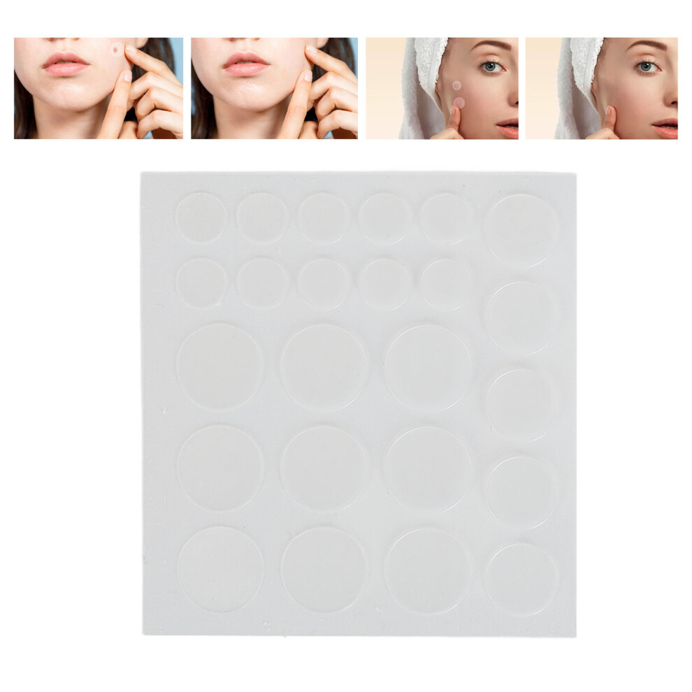 216Pcs Pimple Patches: Compact & Isolating Acne Treatment Solution