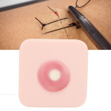 Tampon d'entraînement pour incision et drainage d'abcès - peau en silicone pour kyste sébacé et suture
