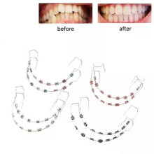 1Pair Colorful Temporary Tooth Decoration With Metal Wires Metal Bracket And Orthodontic Ligature Ties