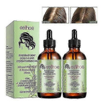 (2PCS) 1-3Pcs Rosemary Essential Oil - Hair Growth Skin Care Treatment
