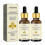 (2PCS) 1-3PCS Advanced Bee-Venom Serum Anti-Aging Moisturizer for Face and Neck 1