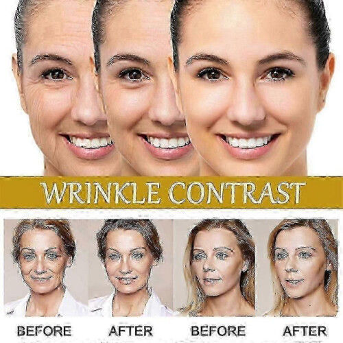 (1PC) 1-3PCS Advanced Bee-Venom Serum Anti-Aging Moisturizer for Face and Neck 2