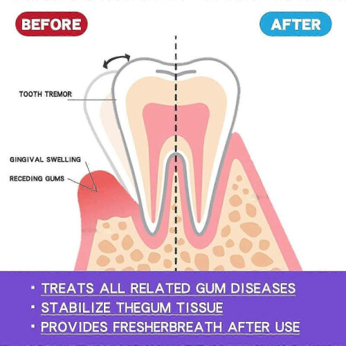 Eelhoe Gum Foam Mousse Care Gums Deep Clean Teeth Dirt Cleaning Mousse Toothpaste 2