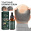 7days Hair Growing Serum, Anti-detachment,hair Development30ml 1