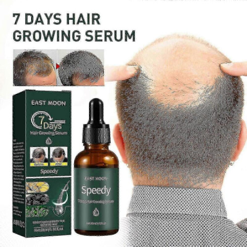7days Hair Growing Serum, Anti-detachment,hair Development30ml