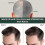 7days Hair Growing Serum, Anti-detachment,hair Development30ml 5
