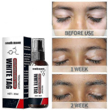 Vitiligo Spray, Vitiligo Treatment for Skin Vitiligo, Vitiligo Care Spray for Reduce White Spots