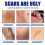 (3PCS)1-3X Acnes Scars Removal Cream Strong Effectiveness Non-irritating Cream for Face Body 3