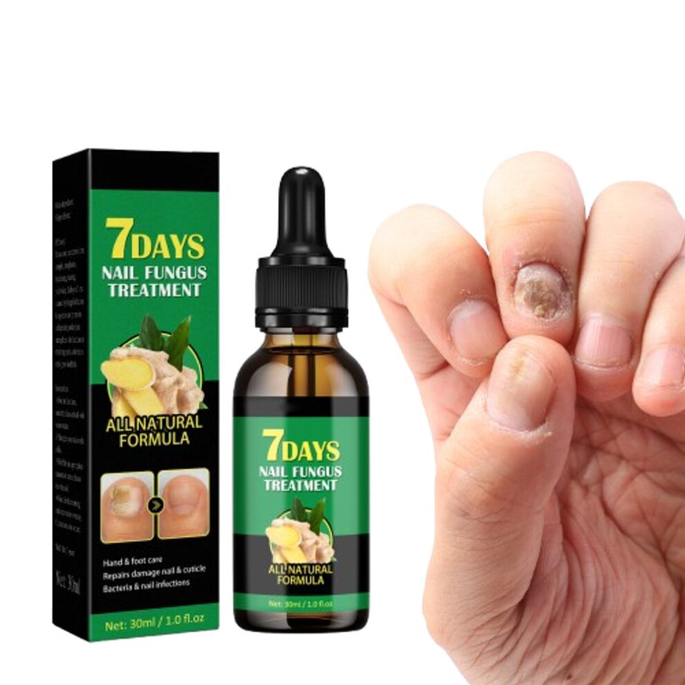 2x Nail Fungal Essence Anti Infection Paronychia Ginger Onychomycosis Gel-image-OPC-PJG22S5-NEW