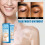 White Spot Reduction Moisturizing Cream 2