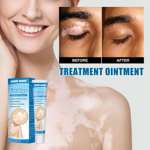 White Spot Reduction Moisturizing Cream 1