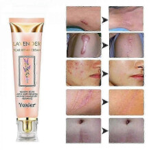 20g Lavender Scars Repair Cream Effective Acnes Scars Removal Gel for Women Men NEW A