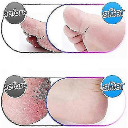 [4 Pack] Emjoi Micro Pedi Extra Coarse Replacement Rollers 2