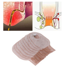 Comfortable Fit 10PCS Ostomy Bags: Leakproof One Piece Design