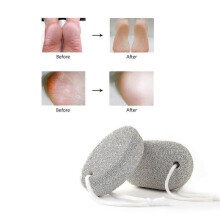 Natural Pumice Stone for Feet - Callus Remover And Foot Exfoliation Tool