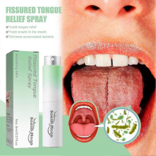 Breath Freshener Spray Fresh Mint Flavor Natural Essence Fissured Tongue Relief Spray BUY 1 GET 2