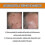 (2pcs)Bee Venom For Warts And Papillomas 3
