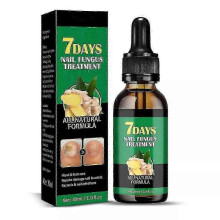 (1pc)Ginger Nail Treatment Nail Care, Nail Growth Oil for Cuticle Nourishment