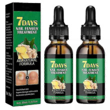 (2pcs)Ginger Nail Treatment Nail Care, Nail Growth Oil for Cuticle Nourishment