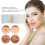 Ultra Thin Reusable Silicone Scar Sheets Tape 2.5cm x 1.5m Roll 10