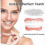 (1pc) Silicone Dentures Reline Set, Silicone Relining Dentures Set, Dentures Silicone Relining Kit, Dentures Set, Dentures Relining Kit 1