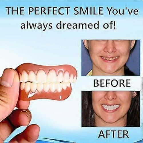 (2pcs) Silicone Dentures Reline Set, Silicone Relining Dentures Set, Dentures Silicone Relining Kit, Dentures Set, Dentures Relining Kit 2