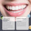 (2pcs)Thermoplastic Denture Adhesive,Ultra Max Hold Denture Adhesive,Clong-Lasting Maintenance 2