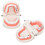 Teeth Caries Educational Model Resin Dental Disease Training Tool for Students 8