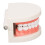 Teeth Caries Educational Model Resin Dental Disease Training Tool for Students 6