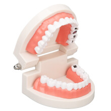 Teeth Caries Educational Model Resin Dental Disease Training Tool for Students