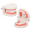 Teeth Caries Educational Model Resin Dental Disease Training Tool for Students 16