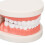 Teeth Caries Educational Model Resin Dental Disease Training Tool for Students 7