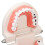 Teeth Caries Educational Model Resin Dental Disease Training Tool for Students 5