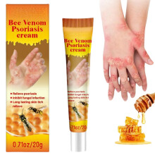 Bienengift-Psoriasis-Creme, Bienengift-Creme für Psoriasis, Bienengift-beruhigende Psoriasis-Creme gegen Rötungen und Juckreiz, Creme zur Linderung