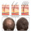(1pcs) 1/2pcs 30ml Keratin Hair Serum 3