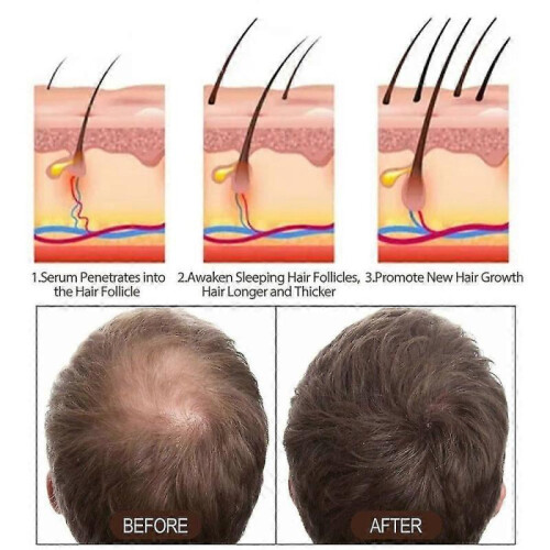 (1pcs) 1/2pcs 30ml Keratin Hair Serum 2