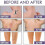 Liquid Concealer for Body Scars 5