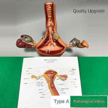 (A) Ovary And Uterus Dissection Pathology Female Uterus Teaching Anatomy Lesion Uterus