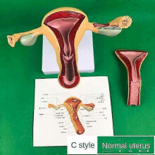 (C) Ovary And Uterus Dissection Pathology Female Uterus Teaching Anatomy Lesion Uterus