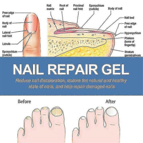 (2pcs)Nail Care Gel 2