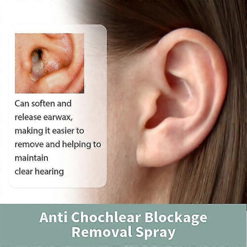 Anti Tinnitus Earwax Removal Spray 30ml 2