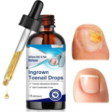 Ingrown Toenail Treatment Drops Extra Strength Nail Repair Solution Cuticle Care Oil for Toenails
