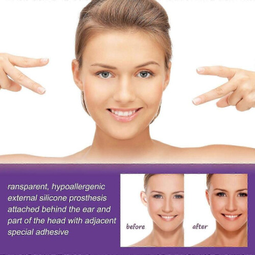 (6PCS) Ear Corrector, Protruding Ear Correctors Solves Big Ear Problem - Aesthetic Correctors Corrective Ear Care 2