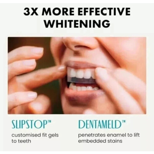 Eclat Teeth Whitening Strips | 14 Treatments for White Smile 1