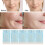5 Stück Protein-Fadenlifting-Set - resorbierbar 12