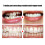 Clear Orthodontic Retainer Brace - Corrects Crowded Teeth for All Ages 7