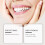 Premium Denture Set, Customized Full Silicone Dentures for Comfort, Soft and Durable, One Piece 3