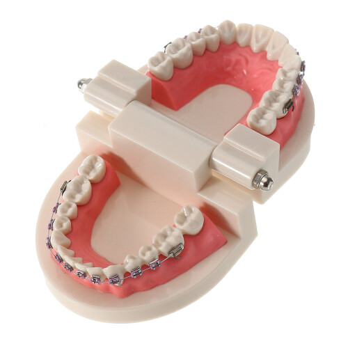 Dental Teeth Malocclusion Orthodontic Model With Full Metal Brackets Hoops Dentist Teaching 2