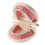 Dental Teeth Malocclusion Orthodontic Model With Full Metal Brackets Hoops Dentist Teaching 2